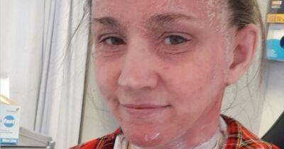 Scots mum's eczema cream hell left skin so bad strangers took pictures behind her back - www.dailyrecord.co.uk - Scotland