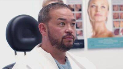 Jon Gosselin Undergoes Hair Transplant Surgery, Wants to 'Get Back in Shape' (Exclusive) - www.etonline.com - Miami