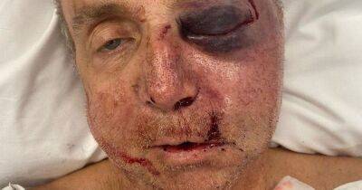 Man left disfigured by neighbour after being battered during garden dispute - dailyrecord.co.uk - city Victoria