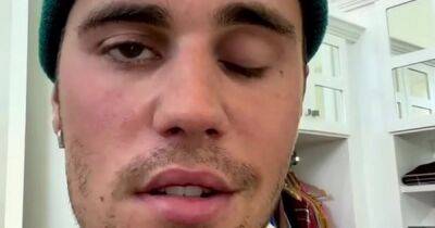 Justin Bieber - What is Ramsay Hunt syndrome as Justin Bieber reveals paralysed face in video - dailyrecord.co.uk