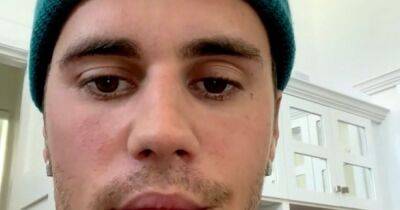 Justin Bieber's 'severe' face paralysis could cause 'long-term' damage as experts weigh in - www.ok.co.uk