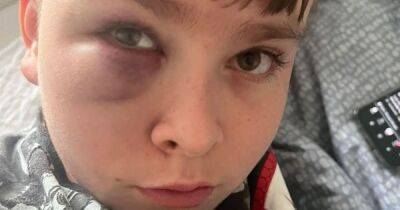 Racist bullies beat boy, 12, pour water on him and try to take his shoes - manchestereveningnews.co.uk - Poland