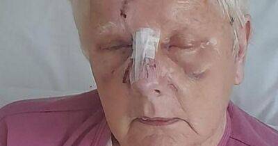 'I thought I was going to die': Pensioner savaged by 'pit bull-type' dog in bloodbath tells of her terror - manchestereveningnews.co.uk - Britain