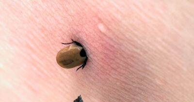 The 'safest way' to remove a tick from a human according to experts - www.dailyrecord.co.uk - Scotland