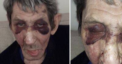 Scots OAP suffers horrific injuries after being 'beaten up and stabbed' in his own home - www.dailyrecord.co.uk - Scotland