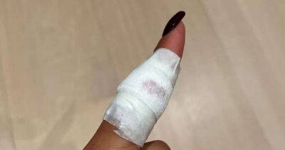 Zendaya injures finger in cooking accident - www.msn.com - county Harrison - county Ford