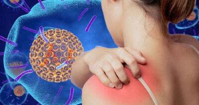 Shingles: The ‘intense' sign that can be ‘mistaken' for something else - how to spot - www.msn.com