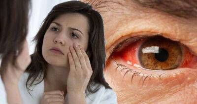 Eyesight: The colours in your eyes that could signal hypertension and high cholesterol - www.msn.com - county Giles