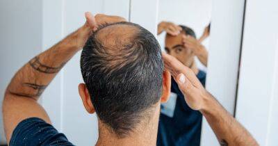 Scientists discover possible cure for baldness that speeds up wound healing - www.dailyrecord.co.uk - California - county Riverside - Beyond