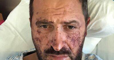 Scots man needed jaw reconstructed after mouth is 'shattered' in unprovoked attack at Belladrum Music Festival - www.dailyrecord.co.uk - Scotland - city Elgin