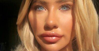 Woman who spent £5k turning herself into 'Barbie' now wants fillers dissolved - www.dailyrecord.co.uk