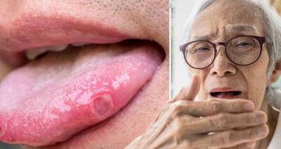 B12 deficiency: The 4 uncomfortable signs on your tongue you could be low on B12 - msn.com