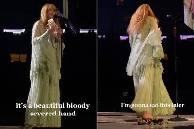 Florence Welch thanks fan for fake bloody severed hand flung onstage - nypost.com - county Florence