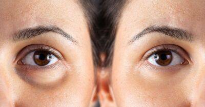 You Could See a Noticeable Difference After Just 3 Days of Using This Eye Cream - www.usmagazine.com