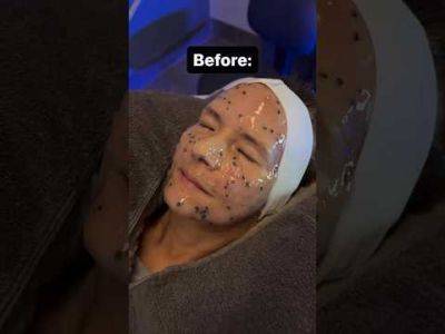 My Mother's Face Looks So Different! Before & After HERE! | Perez Hilton - perezhilton.com - Las Vegas
