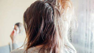Greasy Hair: 10 Ways to Treat and Prevent It, According to Experts - www.glamour.com - New York