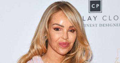 Katie Piper admits 'I find it hard' as she gives insight into operation on her eye - www.ok.co.uk