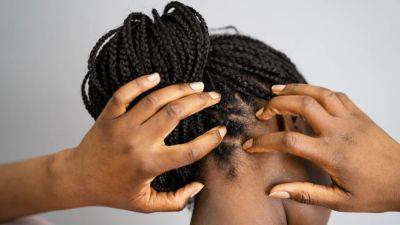 Itchy Scalp and Natural Hair: Products That Work in 2023 - www.glamour.com
