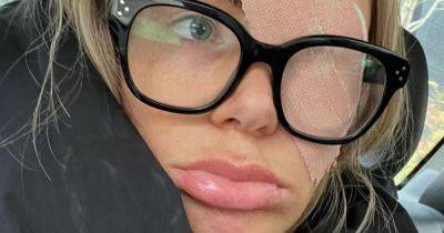 Olivia Attwood unveils eye injury as she takes off patch and shares graphic story - www.ok.co.uk