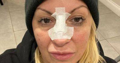Jodie Marsh's nose left 'hanging open' after being bitten by exotic animal - www.ok.co.uk