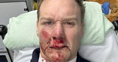 Dan Walker 'glad to be alive' after car smashes into him while riding his bike - www.dailyrecord.co.uk