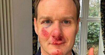 Dan Walker says 'helmet saved his life' in update after being hit by car while cycling - www.ok.co.uk - Charlotte