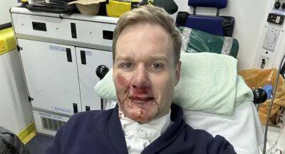 UK Star Presenter Reveals He ‘Could Have Died’ In Horror Bicycle Crash - deadline.com - Britain