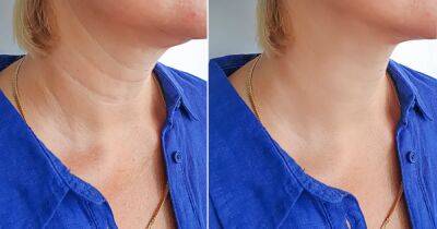 This Neck Tightening Cream Has the Most Incredible Before and After Shots - www.usmagazine.com