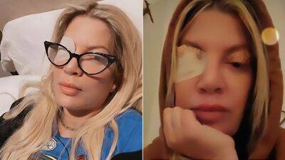 Tori Spelling steps out sporting a bright pink bejeweled eye patch after revealing cornea ulcer - www.foxnews.com - California