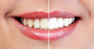 This Teeth Whitening Prewash May Leave You 6 Shades Lighter in 5 Days - www.usmagazine.com - Beyond