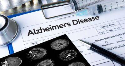 Alzheimer's disease expert reveals treatment could be 'ready by 2040' - www.dailyrecord.co.uk - Britain - Scotland