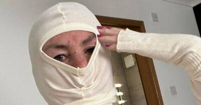 Scots beauty therapist 'addicted' to steroid creams for decades covers rashes with balaclava - www.dailyrecord.co.uk - Scotland