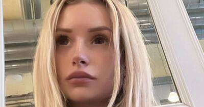 Lottie Moss 'can't move face' after having fillers dissolved in painful procedure - www.ok.co.uk