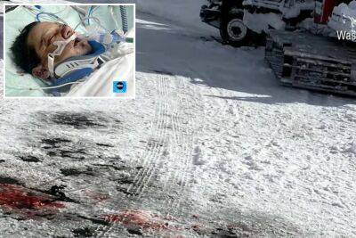 Jeremy Renner’s snowplow accident photos shown for first time on ‘GMA’ - nypost.com - state Nevada - Lake - county Reno