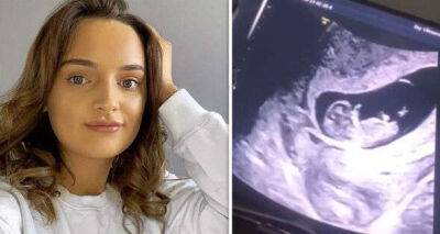 22 Kids And Counting star Millie Radford announces pregnancy with sweet ultrasound clip - www.msn.com
