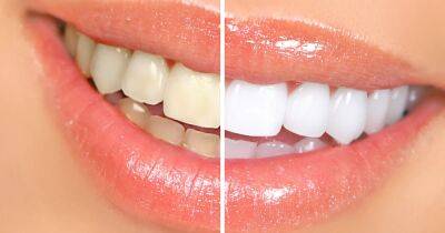 Hate Wearing Whitening Strips? Check Out This Teeth Whitening Pen - www.usmagazine.com