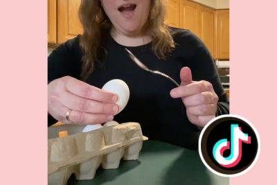 Mom's Entire Face Horrifically Burned While Trying Viral Egg Hack From TikTok - perezhilton.com - Britain - city Manchester, Britain