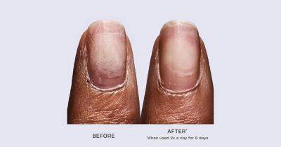 Stronger Nails in 6 Days! This OPI Nail Repair Serum Is Like No Other - www.usmagazine.com - Poland