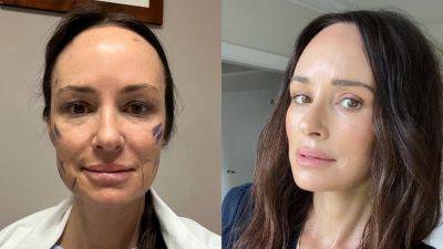 Catt Sadler Got a Facelift, a Neck Lift, and an Eye Lift at 48. She Doesn't Care What You Think About That - www.glamour.com - Indiana