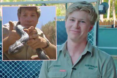 Steve Irwin’s Son Is Just Like His Late Dad -- Matching Gruesome Snake Bites! - perezhilton.com - Australia