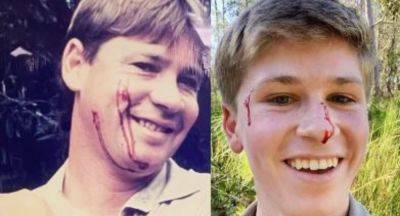 Robert Irwin left bruised and bloodied after alarming animal encounter - www.newidea.com.au - county Irwin
