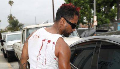 Miguel Leaves Studio With a Briefcase While Wearing Blood-Stained Shirt; Unreleased Demos Released Online - www.justjared.com - Los Angeles