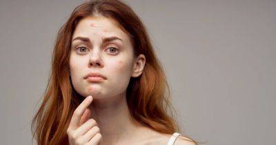 13 Best Acne Spot Treatments to Dramatically Improve Pimples Overnight - www.usmagazine.com