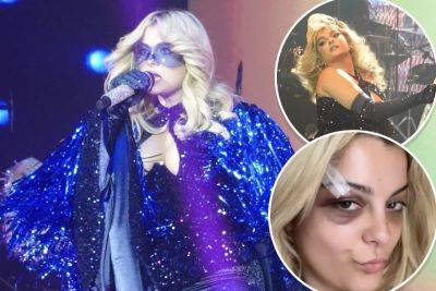 Bebe Rexha wears safety googles during LA performance after being hit with a phone - nypost.com - New York - Los Angeles - state Idaho - county Love
