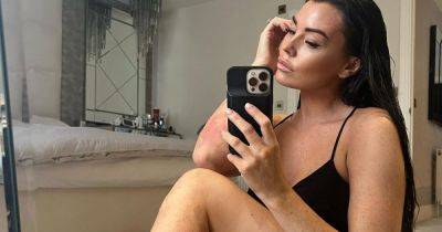How to deal with psoriasis as Jess Wright bravely shows off ‘real skin’ - www.ok.co.uk - Britain