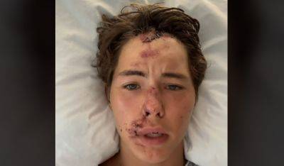TikTok Star Caleb Coffee Gives Update After Falling Off a Cliff - www.justjared.com