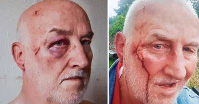Pensioner 'fought for his life' after thug launched vicious attack in his garden - www.dailyrecord.co.uk - Japan