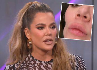 Khloé Kardashian Reveals How She's Dealing With Severe Cheek Indentation Left By Skin Cancer Surgery! LOOK! - perezhilton.com - USA