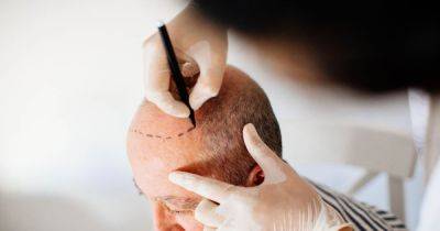 Thinking about a hair transplant in Turkey? Asli Tarcan Clinic has options for you - www.dailyrecord.co.uk - Britain - Turkey - city Istanbul