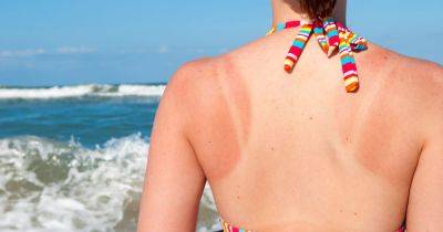 Amazon shoppers rave over 'cooling' £3 aloe vera gel that 'heals sunburn' - www.dailyrecord.co.uk